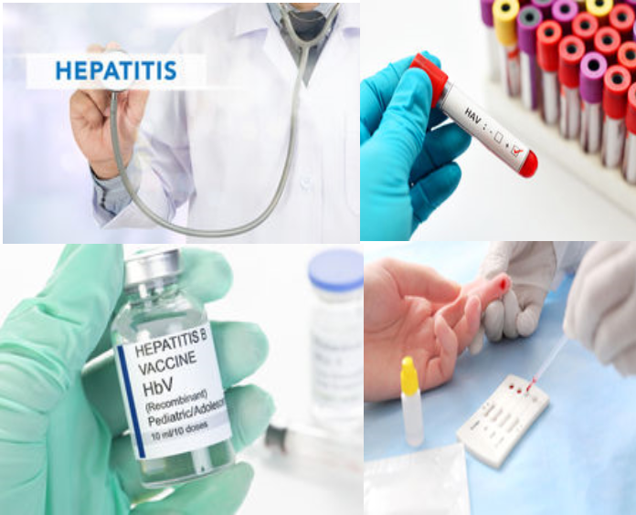 Hepatitis