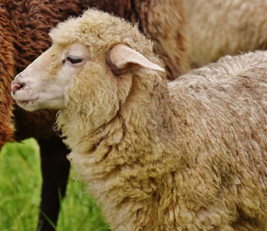Sheep-Human Hybrid to Feed Growing Organ Demand