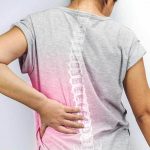 Ankylosing Spondylitis