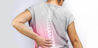 Ankylosing Spondylitis