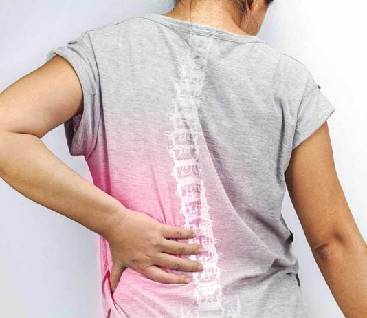 Ankylosing Spondylitis
