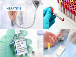 Hepatitis