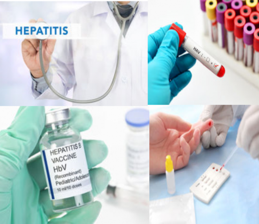 Hepatitis