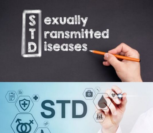 Sexually Transmitted Diseases