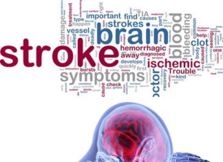 Stroke Stroke