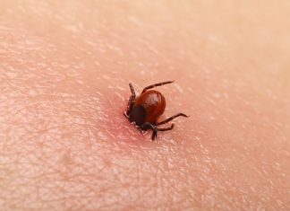 Here’s why you need to stay away from tick bites!