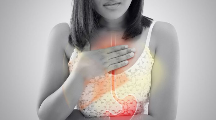 All the Information You Require on GERD and Acid Reflux